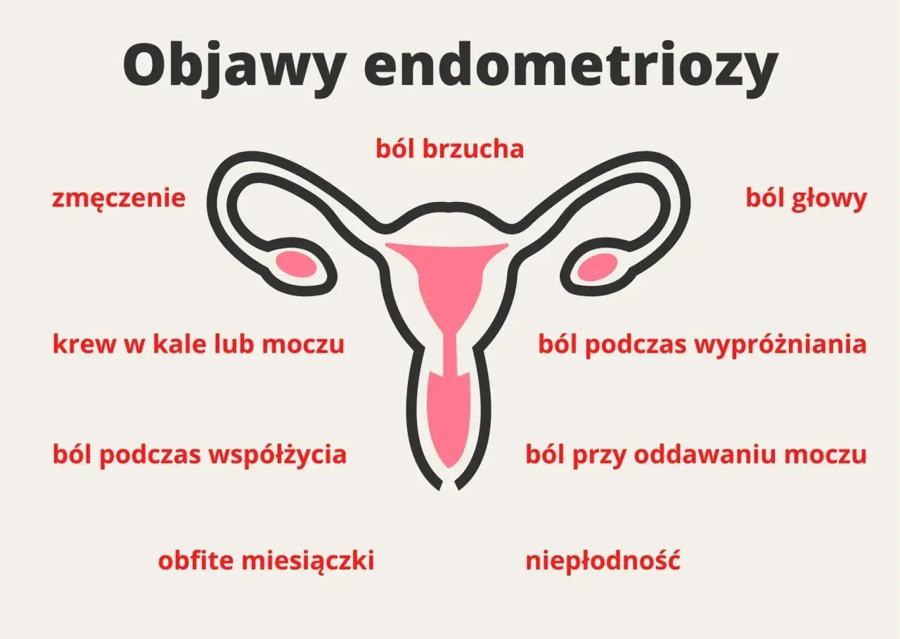 Objawy endometriozy: ból brzucha, zmęczenie, krew w kale/moczu, ból głowy, ból podczas współżycia, ból przy oddawaniu moczu, obfite miesiączki, niepłodność.