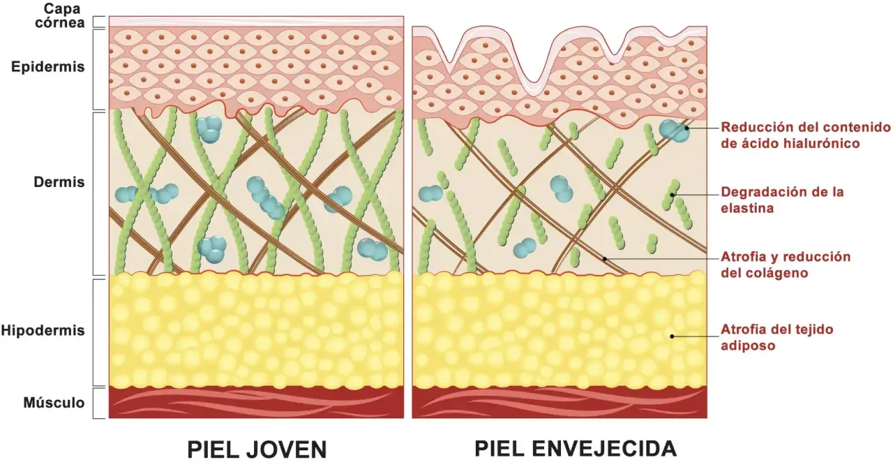 Comparación de piel joven y envejecida, mostrando la degradación de la elastina y la reducción de colágeno en la piel madura.