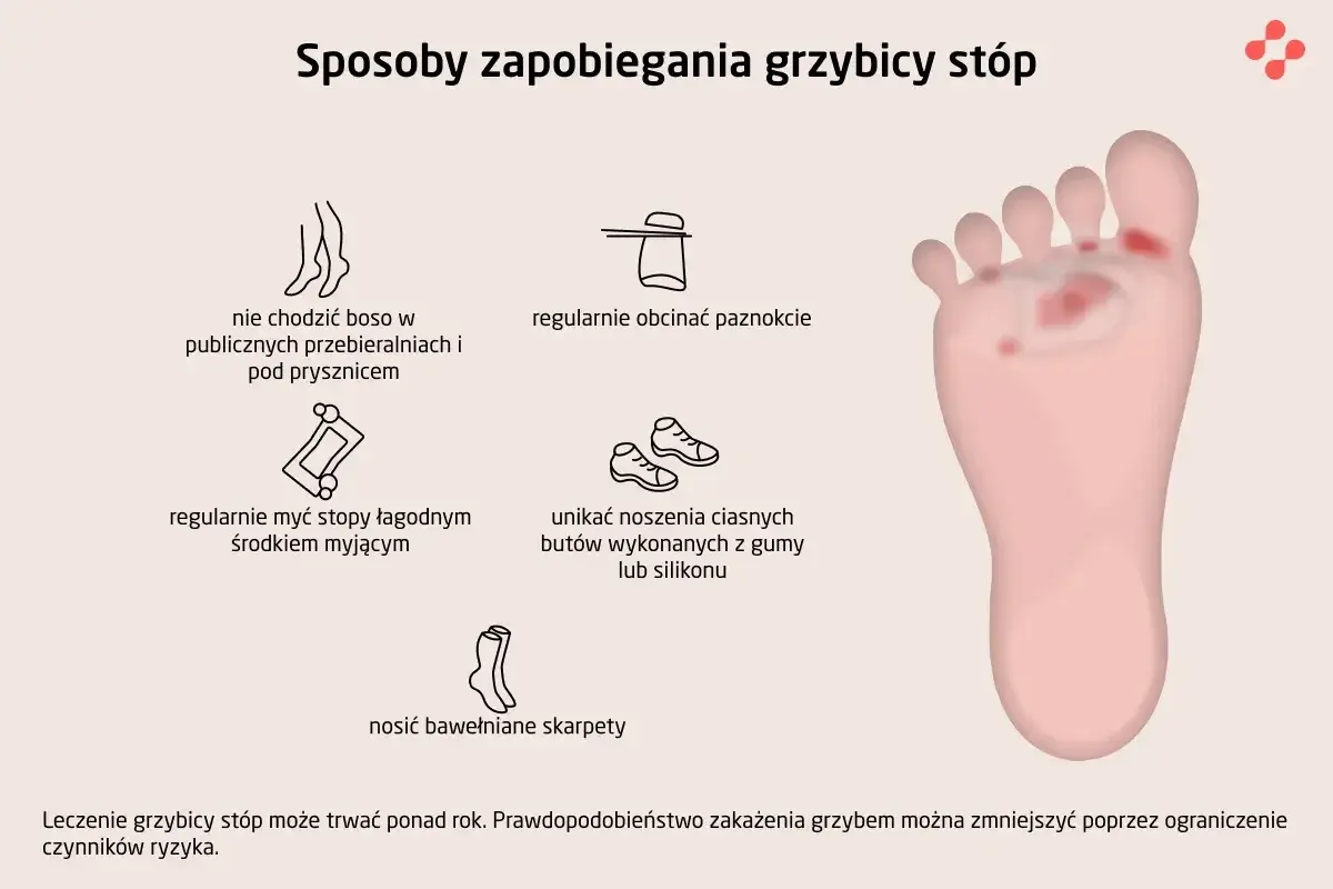 Ilustracja pokazuje sposoby zapobiegania grzybicy stóp: nie chodzić boso, myć stopy, obcinać paznokcie, unikać ciasnych butów, nosić bawełniane skarpety.