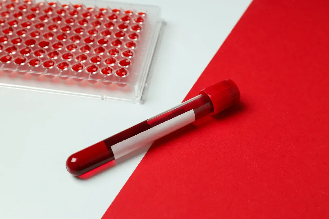 Próbka krwi w probówce i płytka z dołkami do analizy. Zastanawiasz się, ile kosztuje badanie AMH?