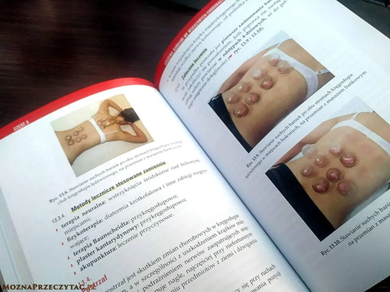 Książka omawia techniki stawiania baniek na plecach, ilustrując je na przykładach.