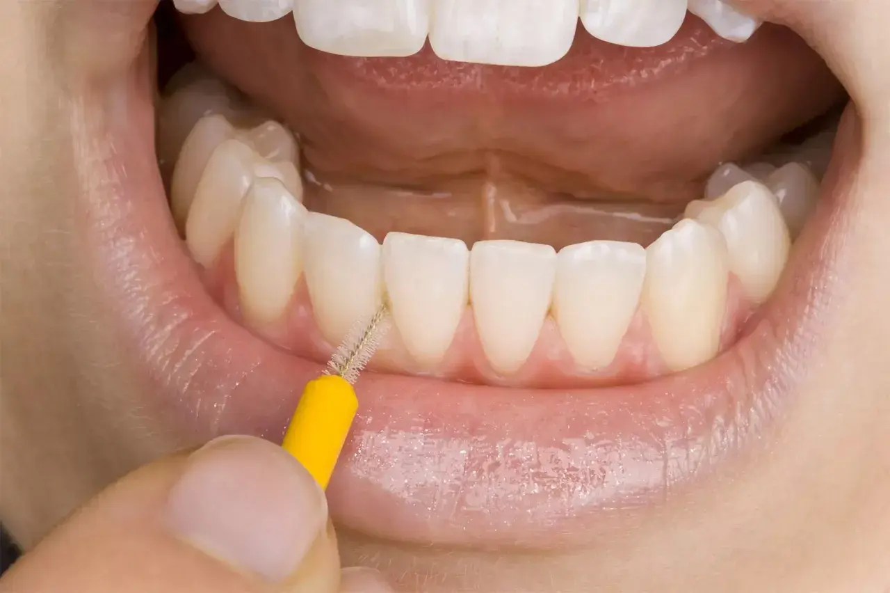 Un primo piano di denti bianchi e gengive sane, con un piccolo scovolino giallo che pulisce tra gli incisivi. La domanda è: il filo interdentale si passa prima o dopo lo spazzolino?