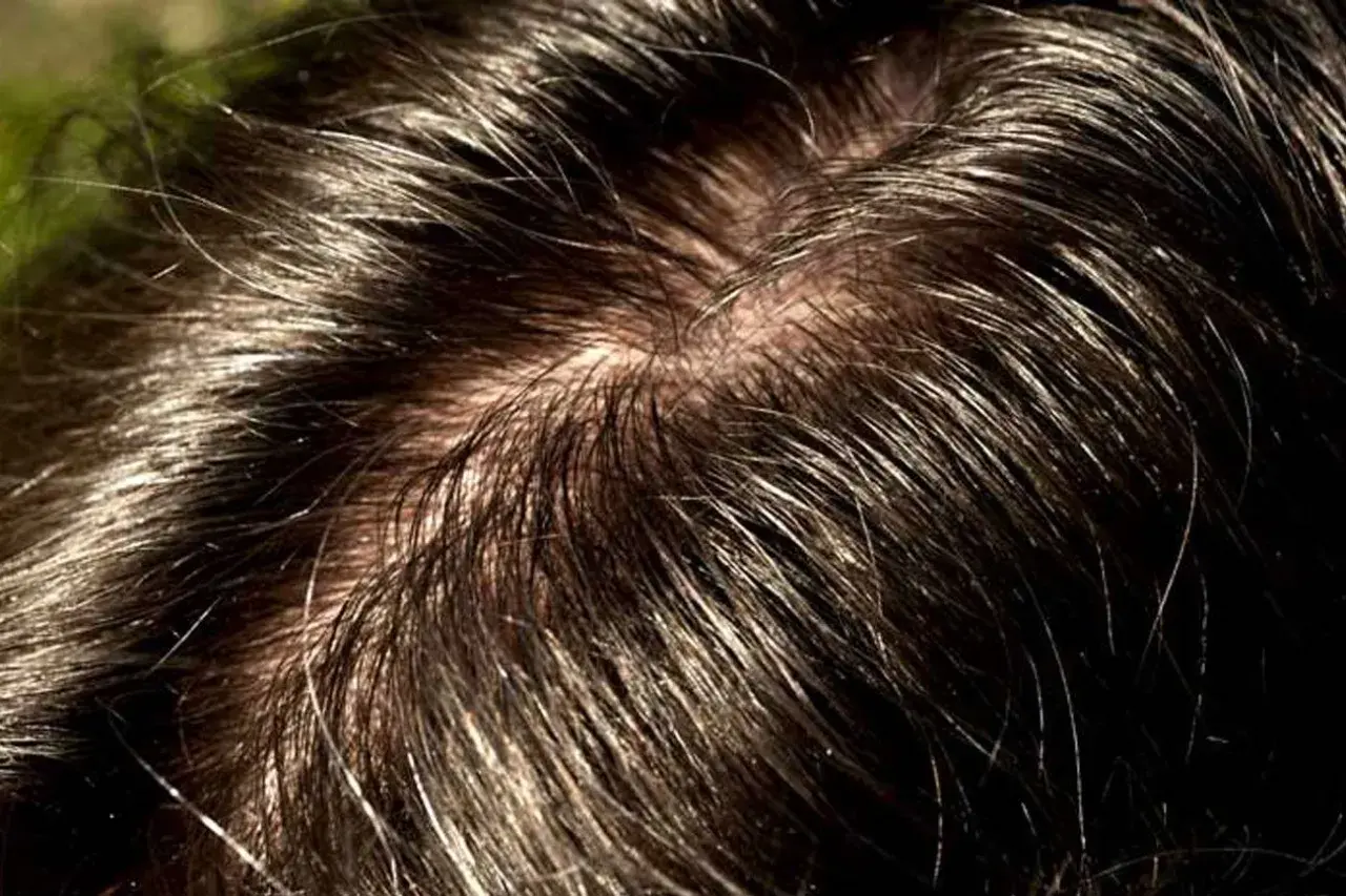 Primo piano di capelli scuri e lucidi, con alcune ciocche che mostrano la tendenza ad apparire unti.