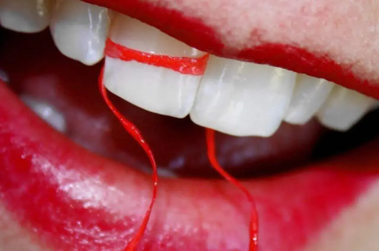 Denti bianchi con filo interdentale rosso stretto tra due, sembra che il filo interdentale faccia male.