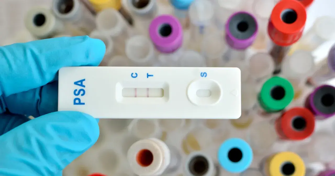 Rękawiczka trzyma test PSA, który wskazuje wynik. W tle widać probówki, co sugeruje badanie psa i przygotowanie do analizy.