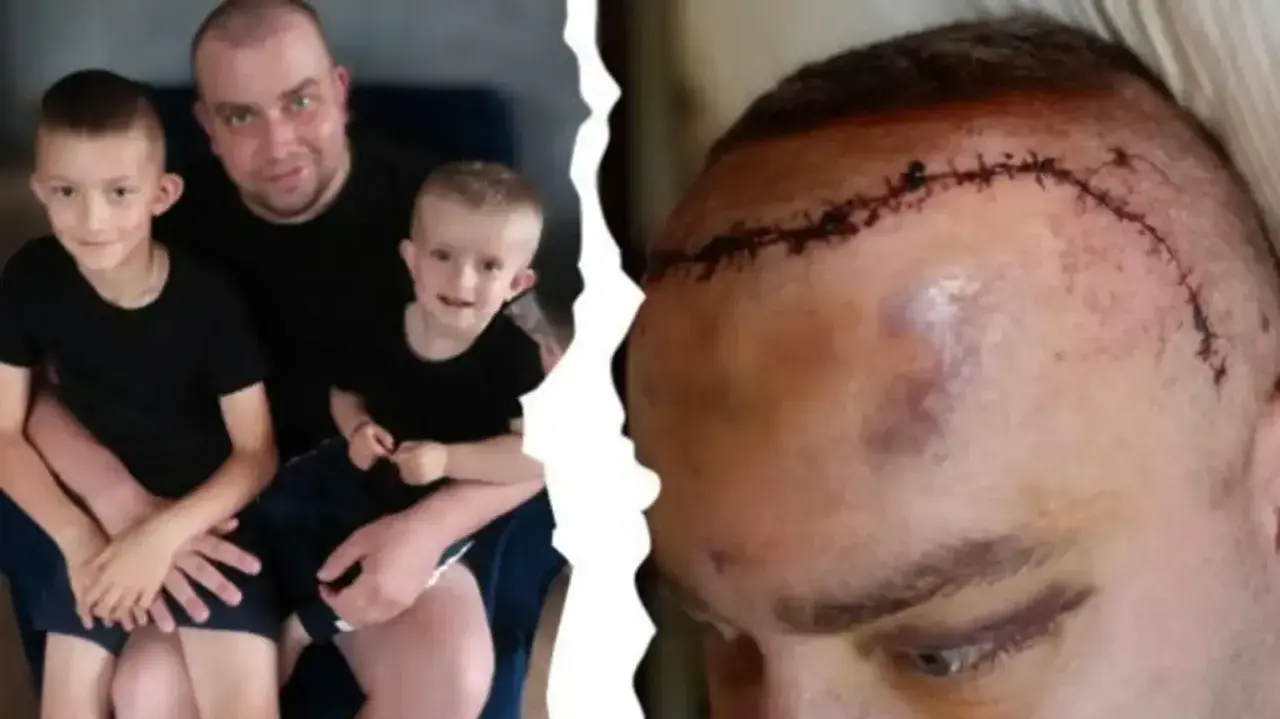 Ojciec z synami i blizna po operacji mózgu. Historia o tym, jak się umiera na glejaka, pokazuje walkę o życie.