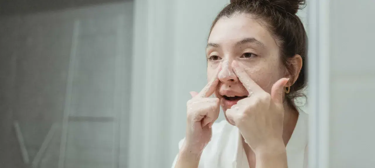 Ragazza si lava il viso, concentrandosi sui brufoli sul naso con schiuma detergente.