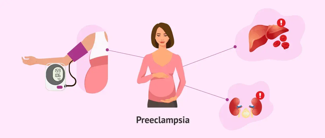 Ilustración de una mujer embarazada con un tensiómetro, hígado y riñones, mostrando los **preeclampsia riesgos** y sus efectos.