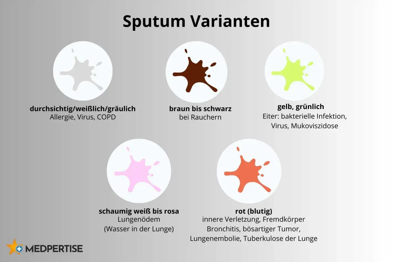 Gelb, grünlich: Eiter bei bakterieller Infektion, Virus, Mukoviszidose. Das Bild zeigt verschiedene Sputum-Varianten.