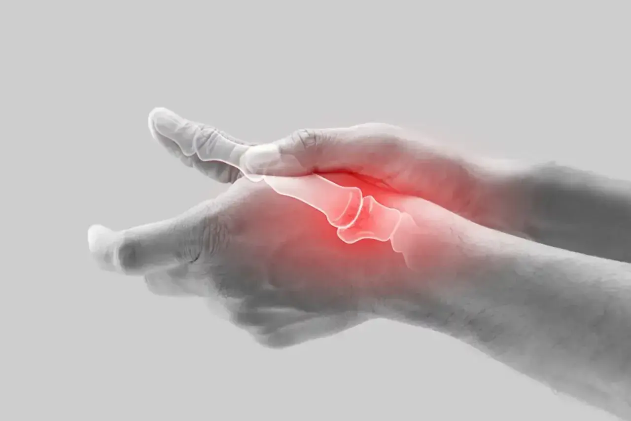 Schmerzende Hand mit gerötetem processus styloideus radii.