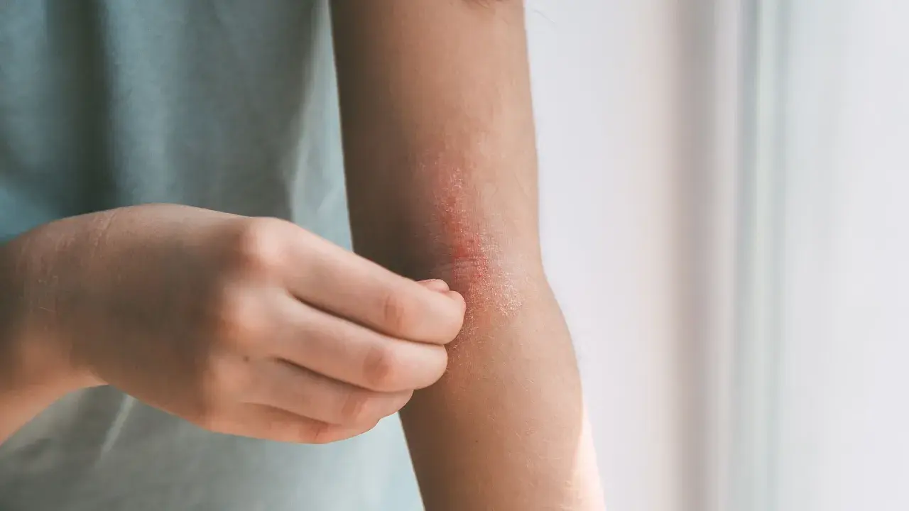 Skóra na łokciu swędzi i jest zaczerwieniona. Czas na wizytę u dermatologa, by znaleźć przyczynę i ulgę.