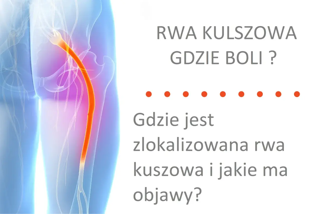 Anatomia nerwu kulszowego z zaznaczonym bólem.