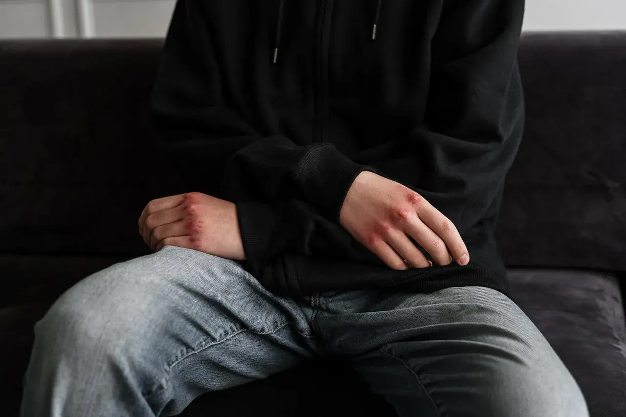 Dłonie z otarciami, siedząca osoba w bluzie i jeansach. To mogą być niebieska karta konsekwencje.