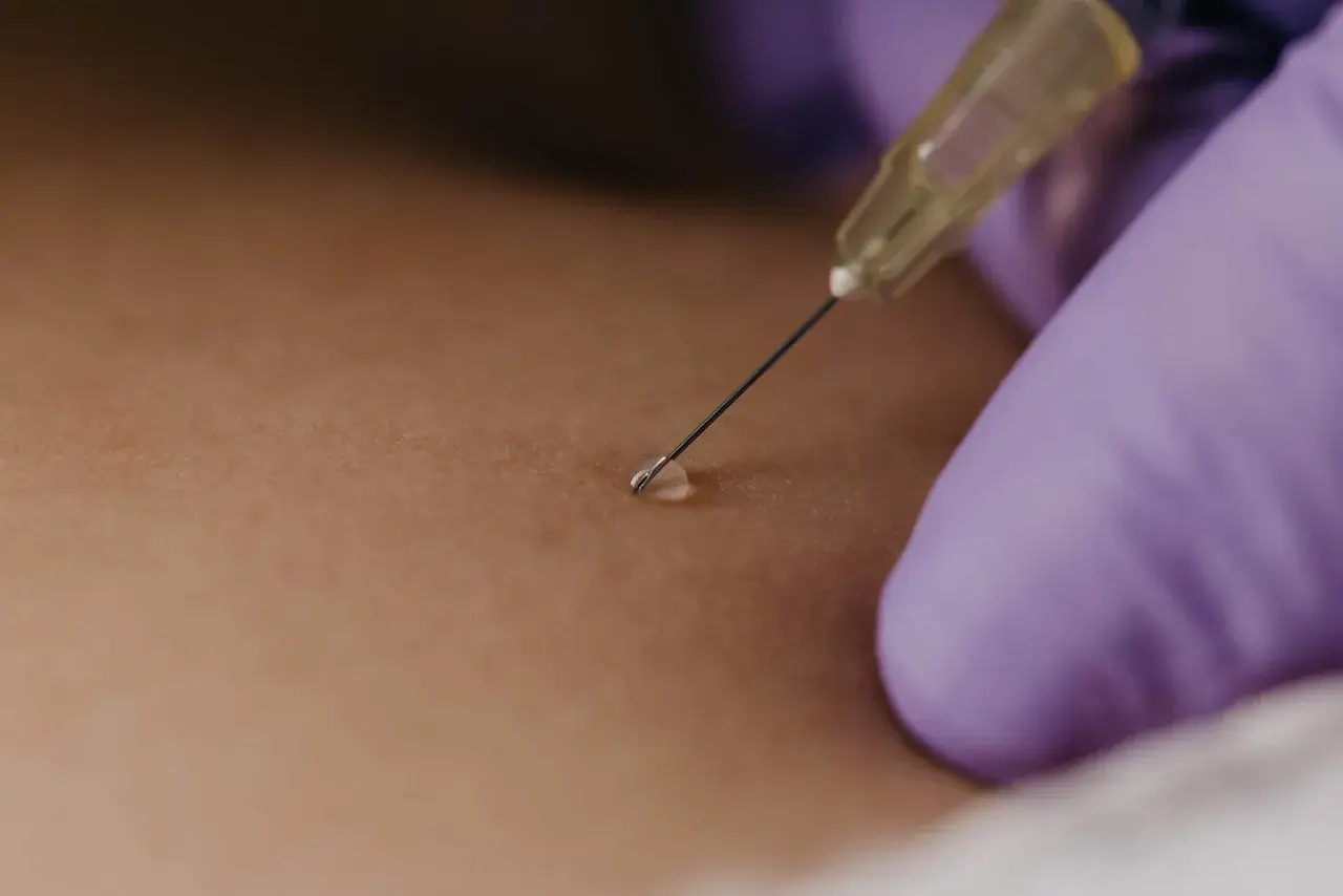 Gros plan sur une aiguille fine pour une infiltration du dos, une goutte de liquide prête à être injectée.