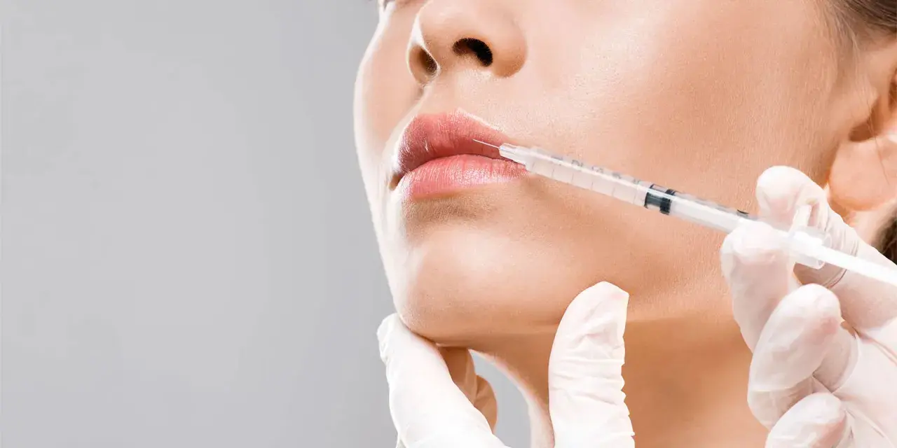 Dalle mani di un'estetista a quelle di un medico estetico: un primo piano di labbra che ricevono un trattamento di filler con siringa.