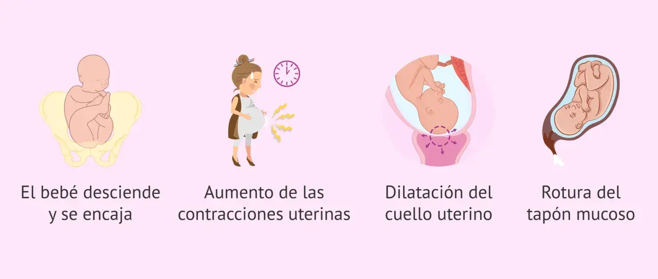 Ilustración de las etapas del parto normal: bebé encajado, contracciones, dilatación y rotura del tapón mucoso.