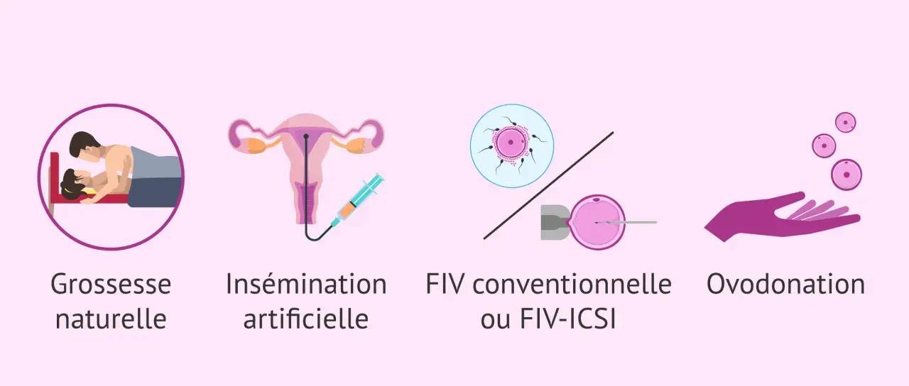 Illustrations de différentes méthodes pour concevoir un enfant, de la grossesse naturelle à l'ovodonation, utiles pour les femmes atteintes d'endométriose.