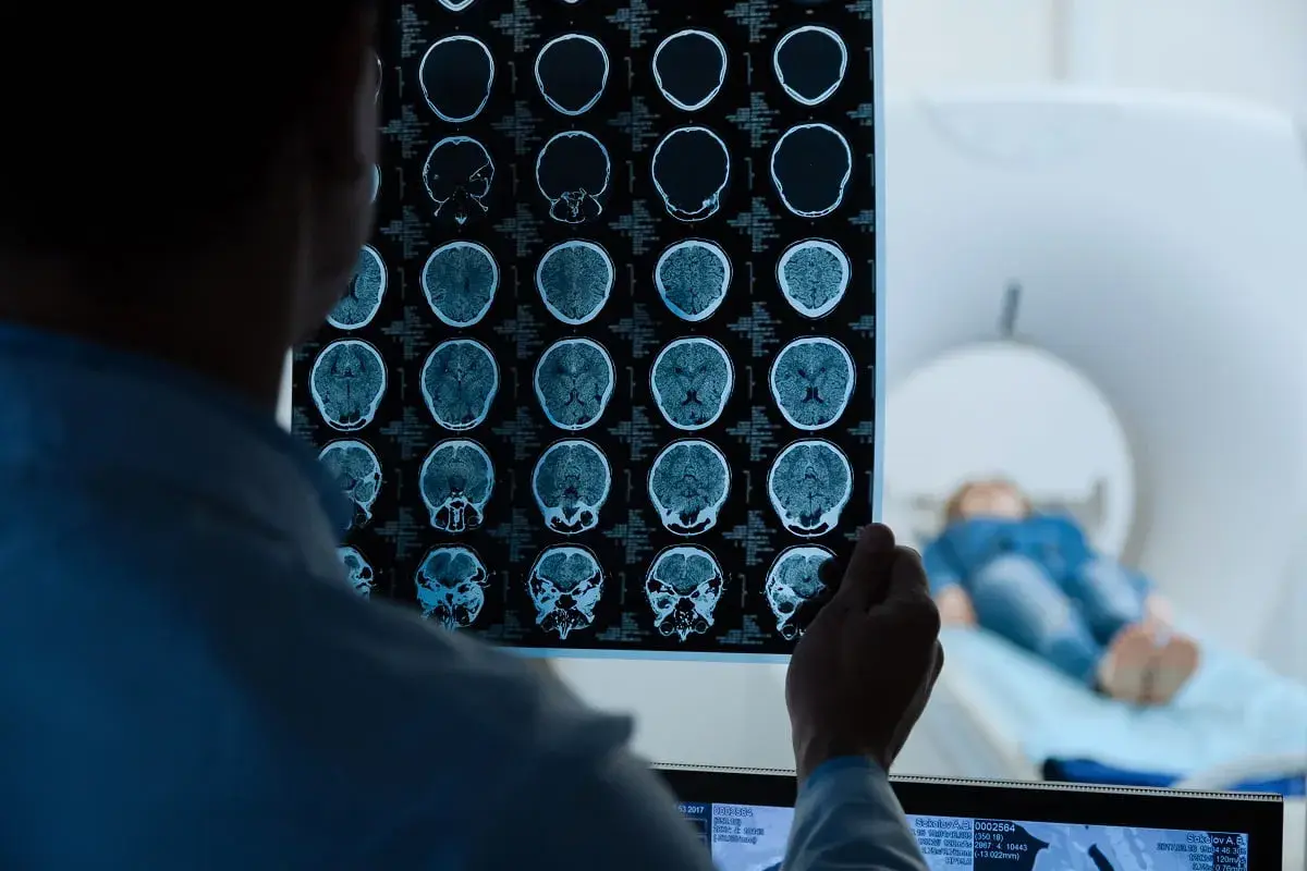 Lekarz analizuje wyniki rezonansu magnetycznego głowy bez kontrastu, szukając powikłań. W tle pacjent leży w aparacie MRI.