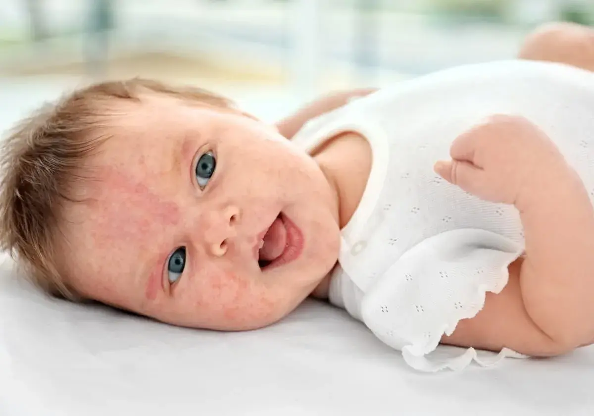 Söt bebis med blå ögon och lite babyakne på kinderna, glad och skrattande.