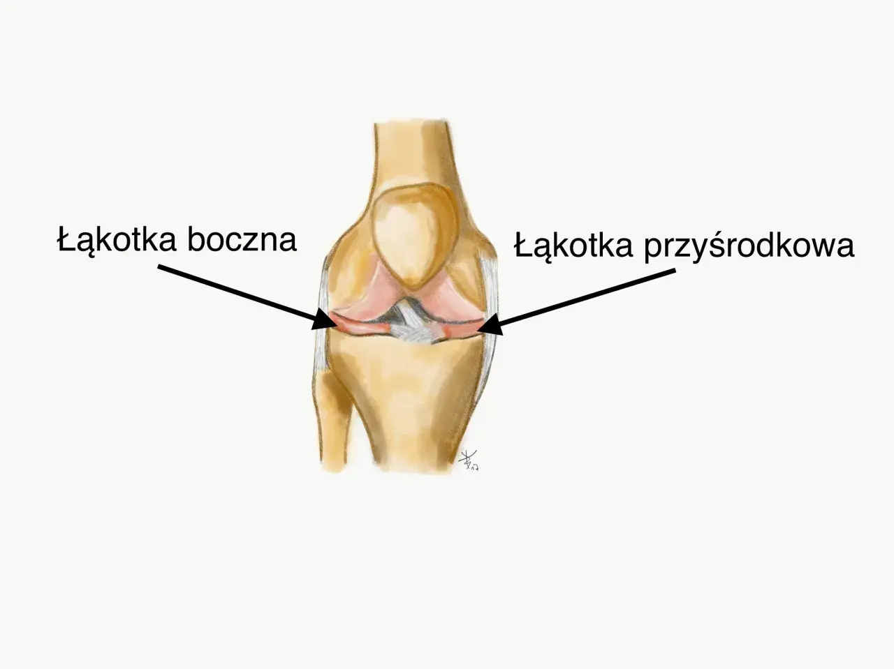 Anatomia kolana z zaznaczoną łąkotką boczną i przyśrodkową.