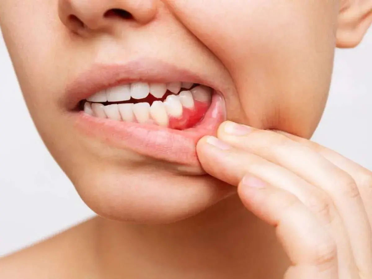 Gengive infiammate e mal di stomaco: un disagio che colpisce tutto il corpo.