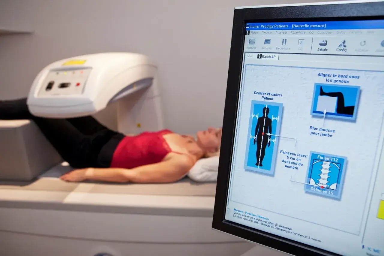 Ile kosztuje badanie na osteoporozę? Ceny, które warto znać