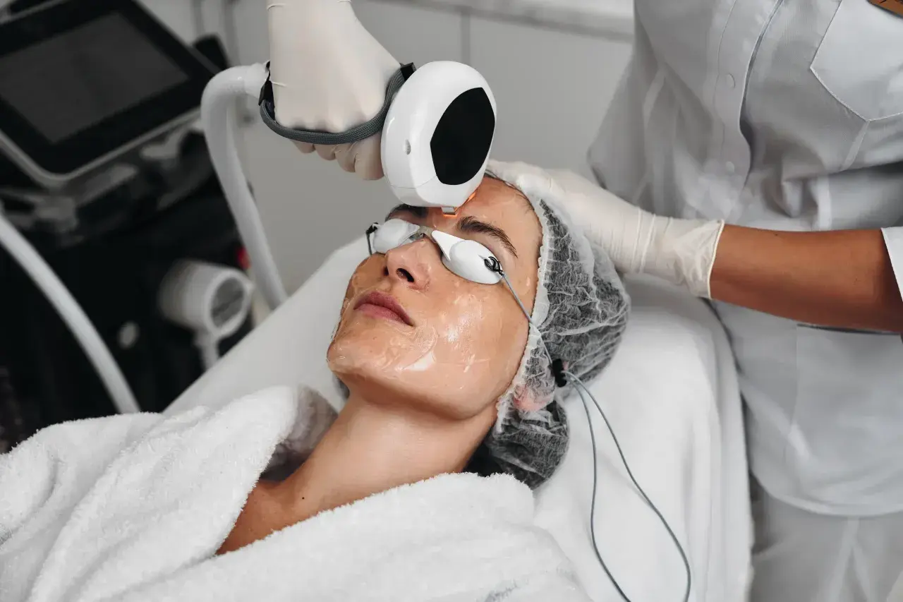 Trattamento estetico per come rimpolpare il viso con laser. Una persona con occhiali protettivi riceve un trattamento sul viso.