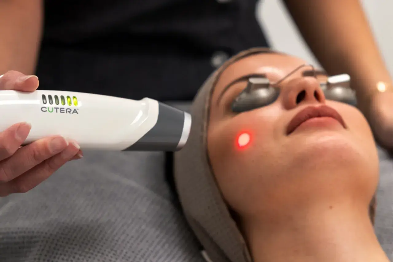 En kvinna får en behandling med laser genesis. En hand håller en laserapparat nära hennes ansikte, där en röd prick syns på kinden.
