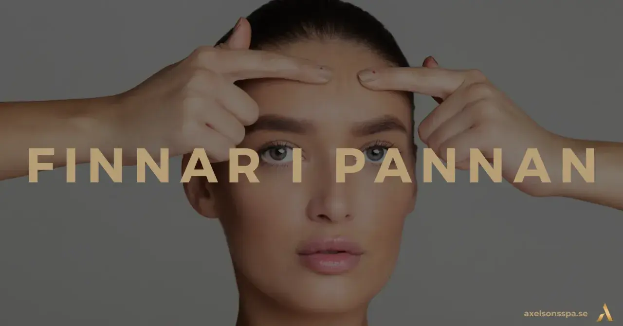 En kvinna undersöker sina finnar i pannan. Texten "FINNAR I PANNAN" syns över bilden.