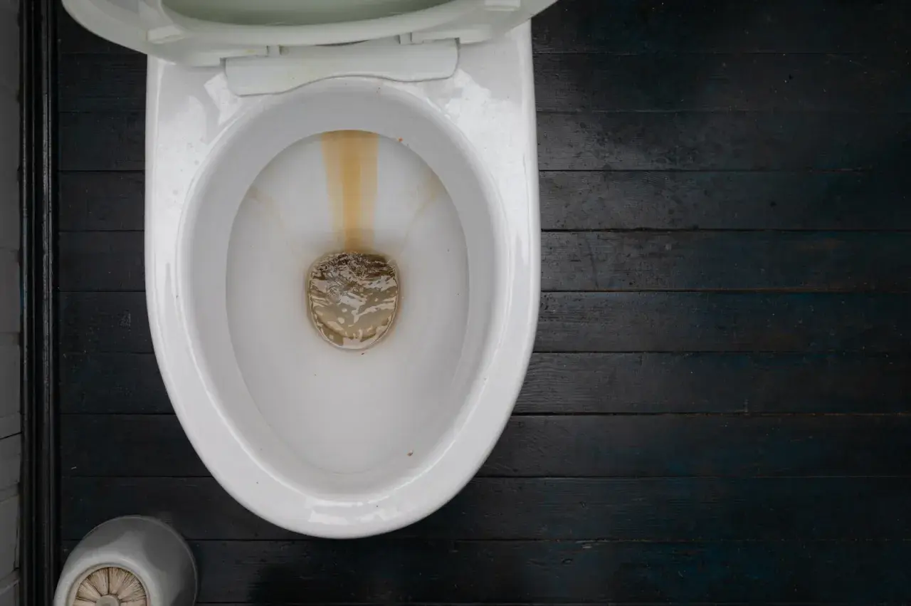 Vergilbte Ränder in der Toilette zeigen, dass es Zeit ist, Urinstein zu entfernen. Hausmittel wie Essig oder Zitronensäure können helfen.