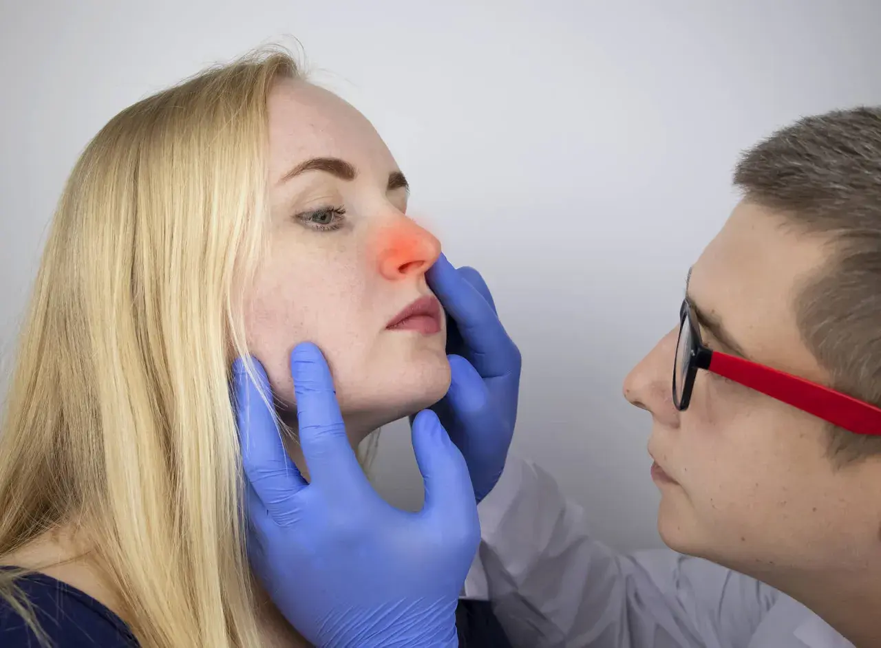 Médico examina la nariz de una mujer con enrojecimiento interno, sugiriendo pupas en la nariz por dentro.