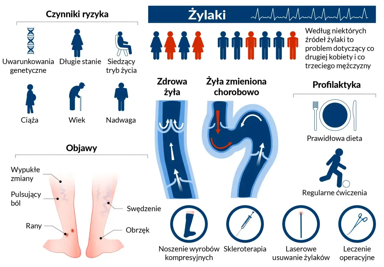 Widoczne nogi z widocznymi pajęczynami naczyniowymi. Lupa powiększa fragment skóry, uwidaczniając żylaki.