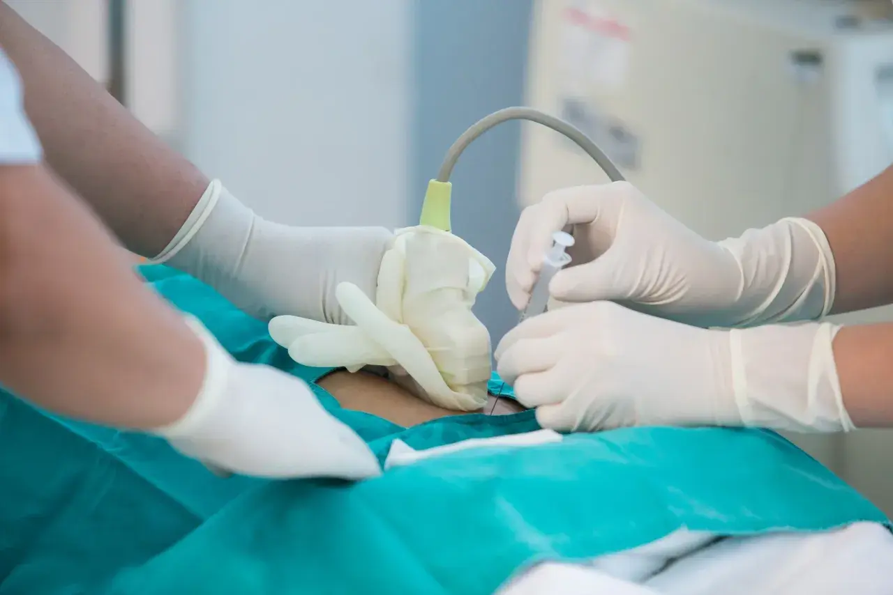 Lekarze w rękawiczkach wykonują amniopunkcję, pobierając płyn owodniowy do badań.