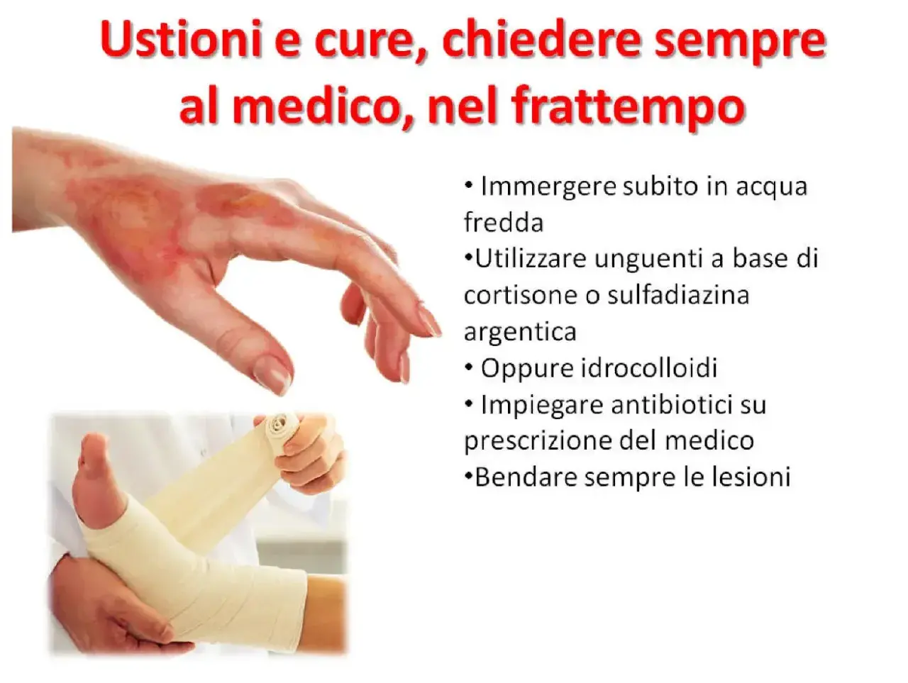 Mano ustionata e piede fasciato. Cosa mettere sulle scottature: acqua fredda, unguenti, idrocolloidi o antibiotici su prescrizione.