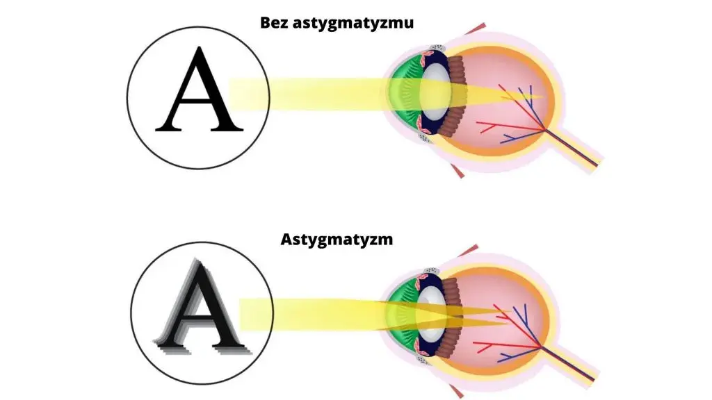 Jak astygmatyk widzi litery? Wyjaśniamy objawy i korekcję
