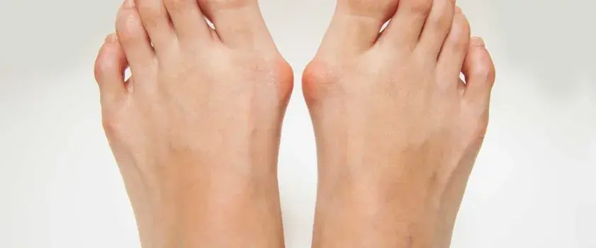 Od czego robią się haluksy? Genetyka, buty i nie tylko!