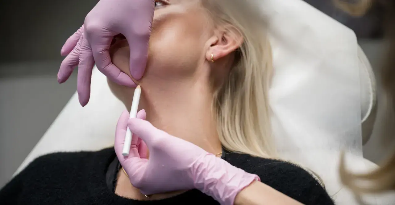 En person får botox i nacken. En hand med rosa handske markerar med en penna på huden.