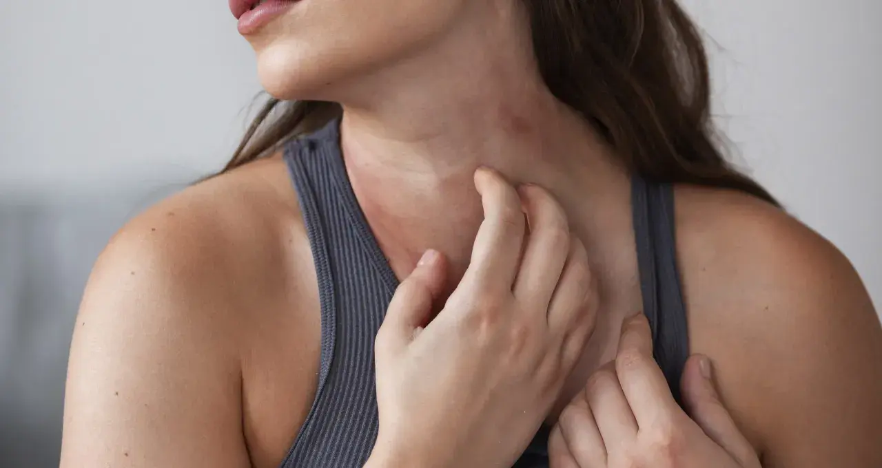 Una mujer se rasca el cuello, mostrando un sarpullido rojo e irritado.