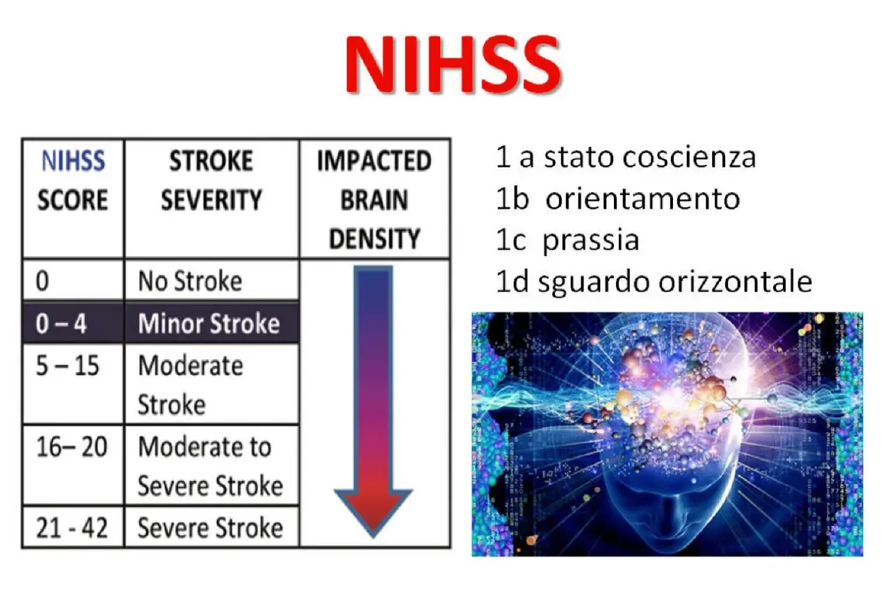 Tabella NIHSS per valutare il punteggio invalidità per ischemia cerebrale, da 0 (nessun ictus) a 42 (ictus grave).