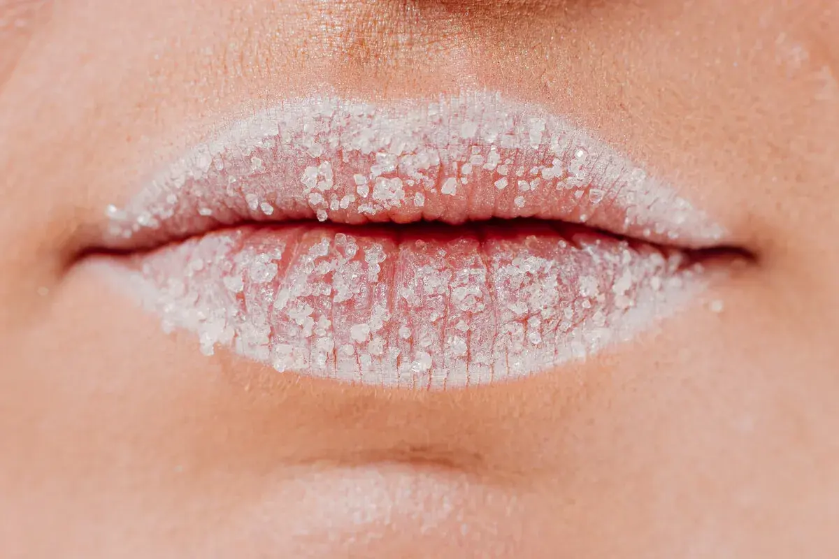 Labios blancos cubiertos de azúcar, posibles causas de sequedad y descamación.