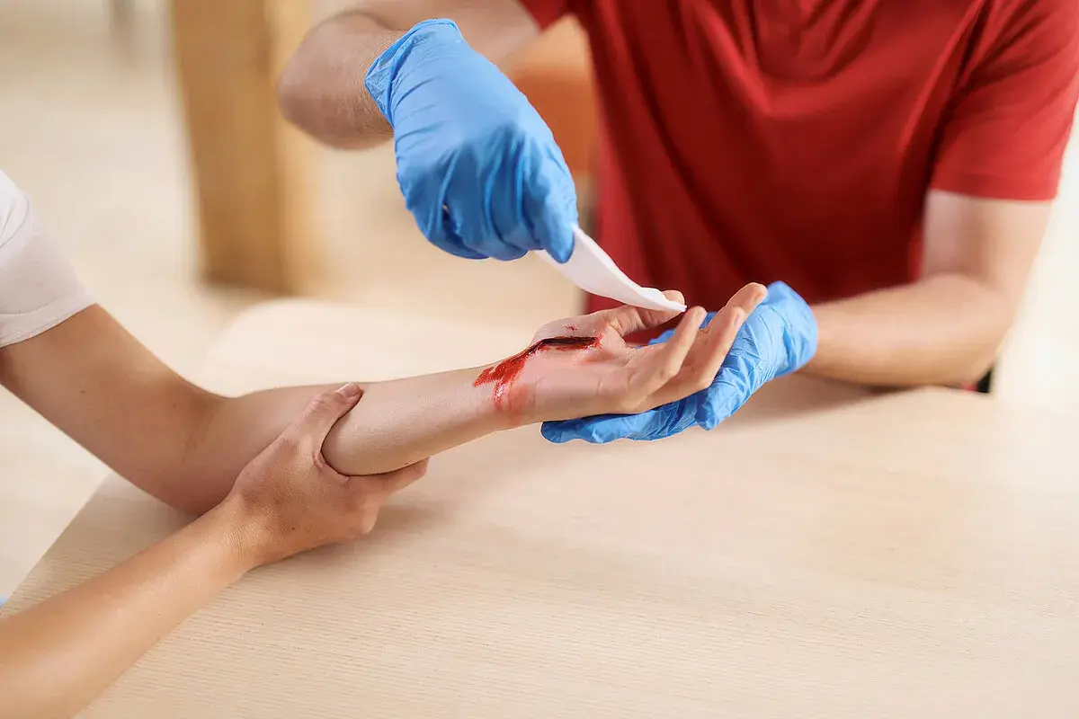 Person mit blauen Handschuhen legt Verband an blutende Wunde an der Hand an, um die Blutung zu stoppen.