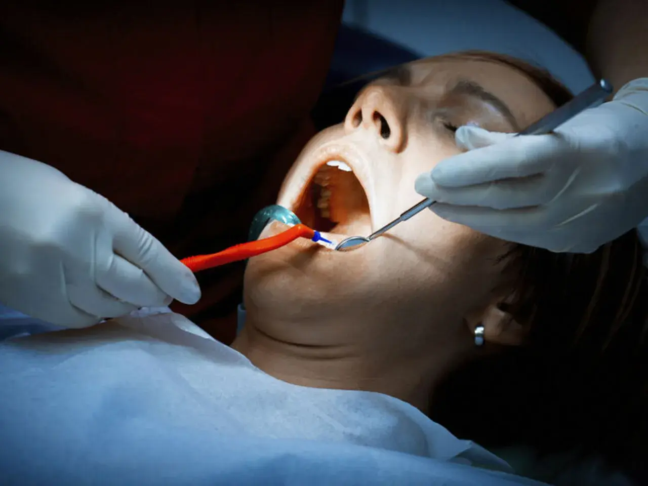 Dentysta bada jamę ustną pacjentki. Czy antybiotyk pomoże na ropień zęba?