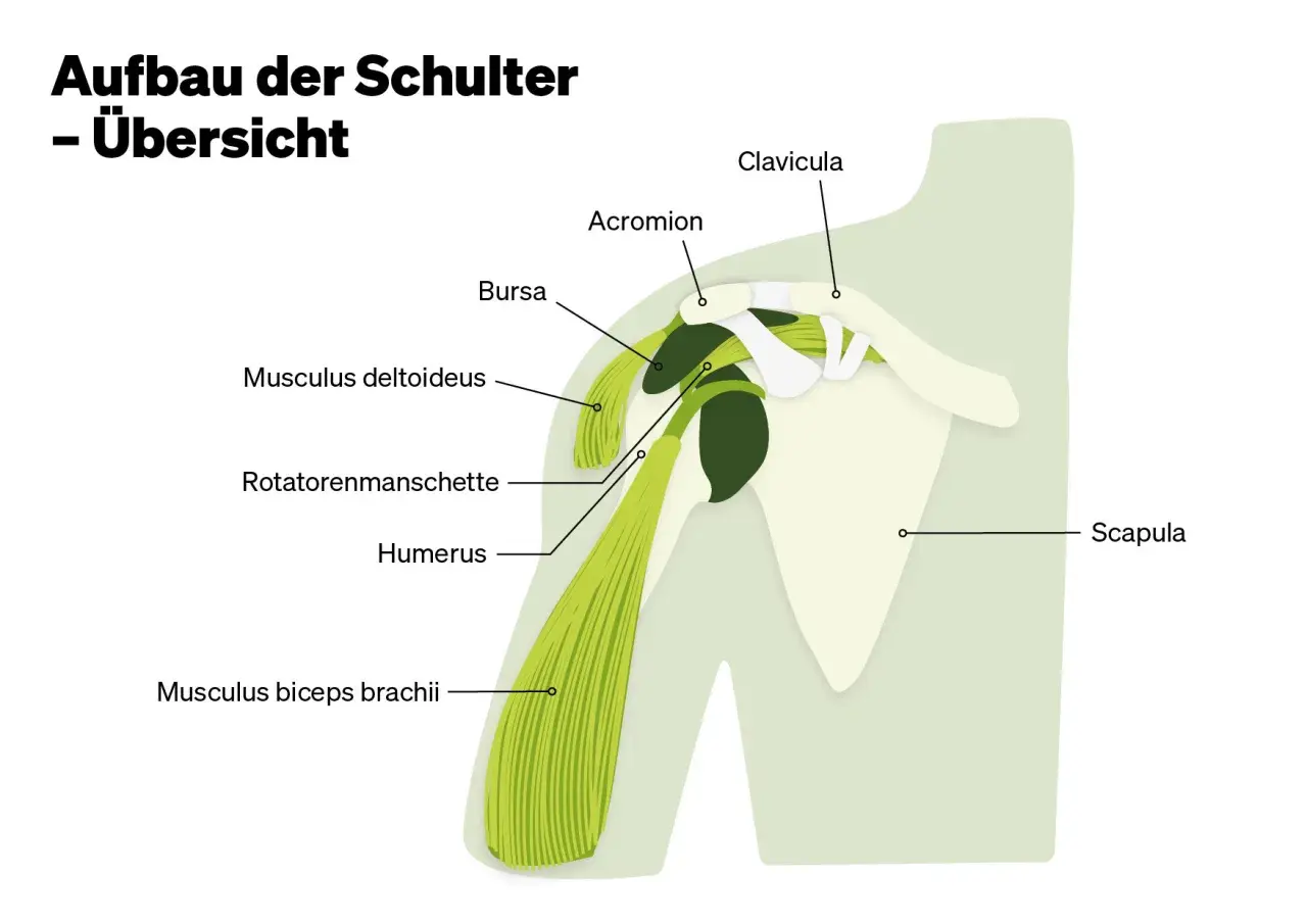 Schulteranatomie: Schulterblatt (Scapula), Oberarmknochen (Humerus), Schlüsselbein (Clavicula), Acromion, Bursa, Deltamuskel (Musculus deltoideus), Bizepssehne (Musculus biceps brachii) und Rotatorenmanschette. Der Levator scapulae ist hier nicht expli...