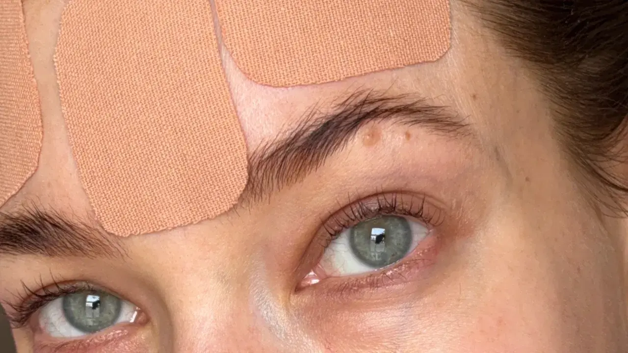 Närbild på ögon och panna med tejpremsor för face taping.
