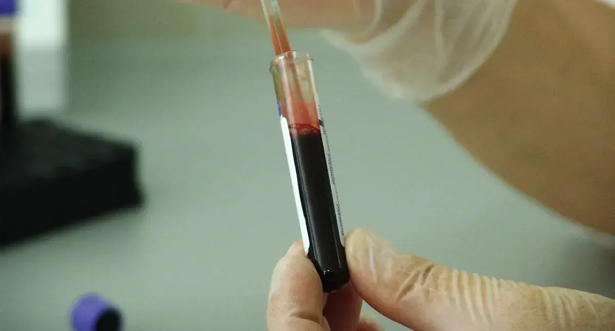 Czy leki na HIV są refundowane? Sprawdź, co musisz wiedzieć o dostępności