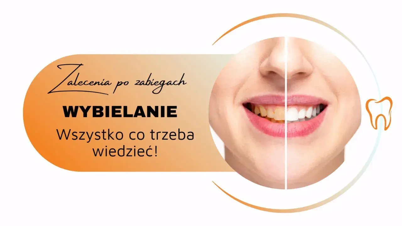 Zalecenia po zabiegach wybielania zębów. Uśmiech przed i po, by cieszyć się olśniewającą bielą.