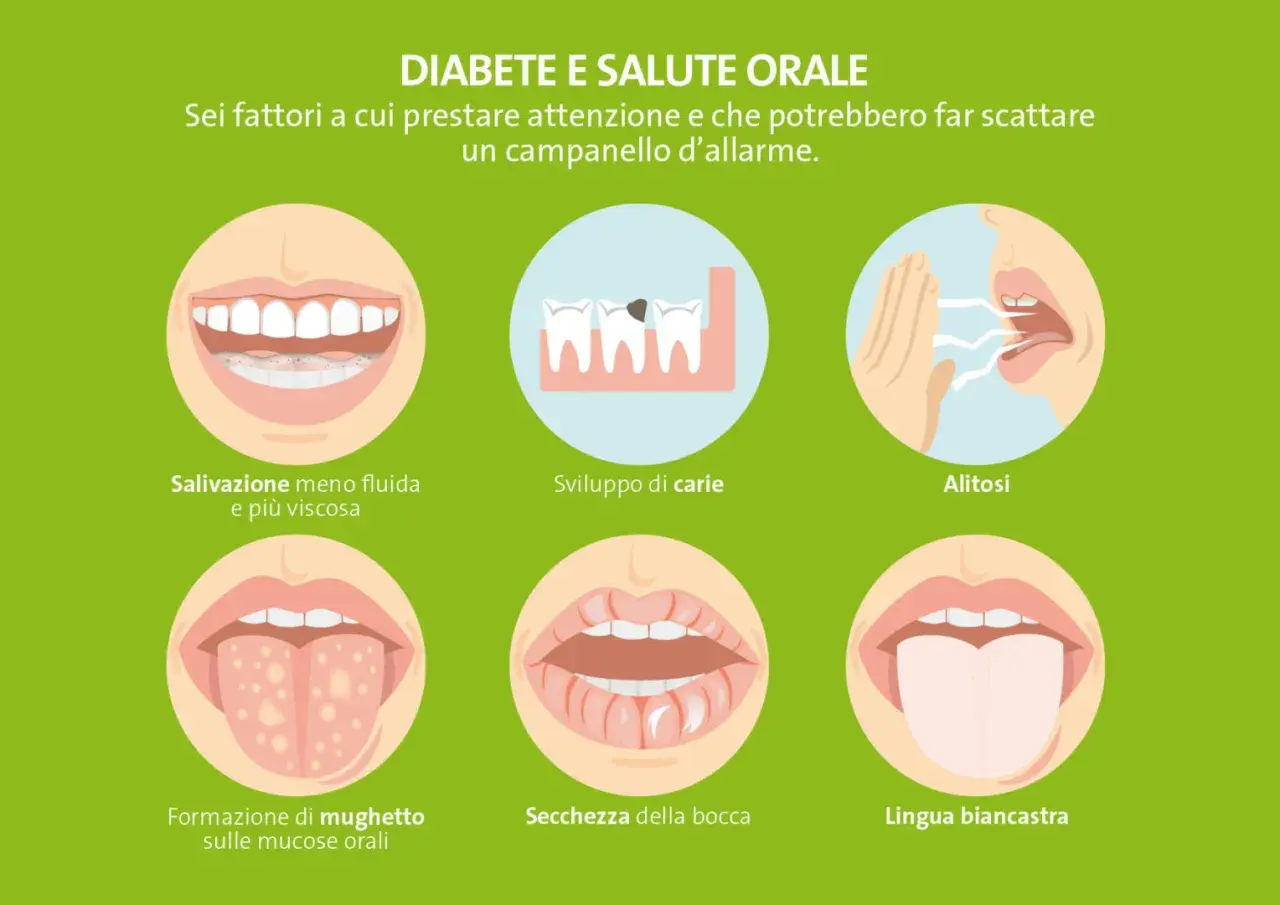 Sei sintomi legati al diabete e alla salute orale: bocca secca, alitosi, mughetto, carie, lingua biancastra e salivazione ridotta.