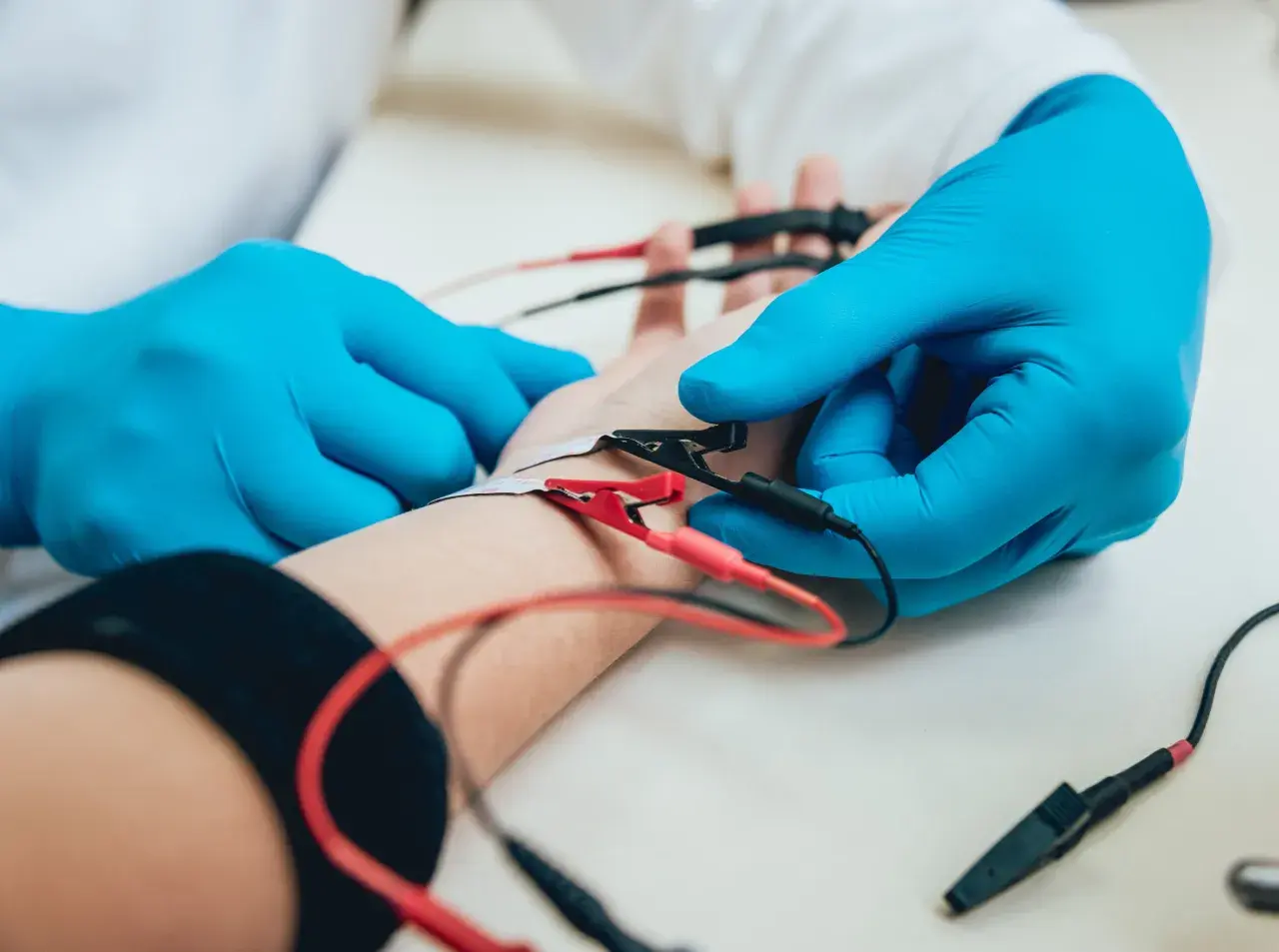 Badanie EMG, czyli elektromiografia, to badanie oceniające funkcję nerwów i mięśni. Na zdjęciu widać elektrody podłączone do ręki pacjenta.