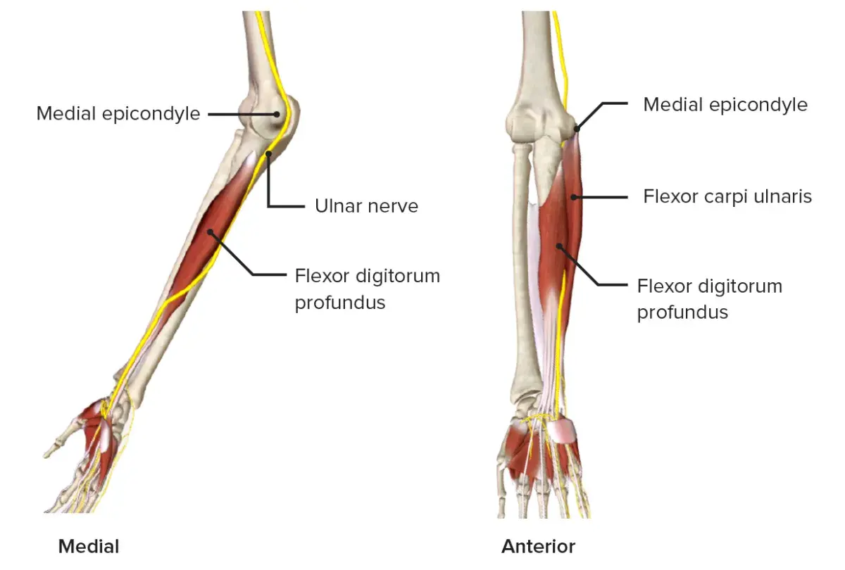 Anatomie des Arms: Nerven und Muskeln. Der Nervus ulnaris verläuft am medialen Epikondylus entlang und versorgt den Flexor digitorum profundus.