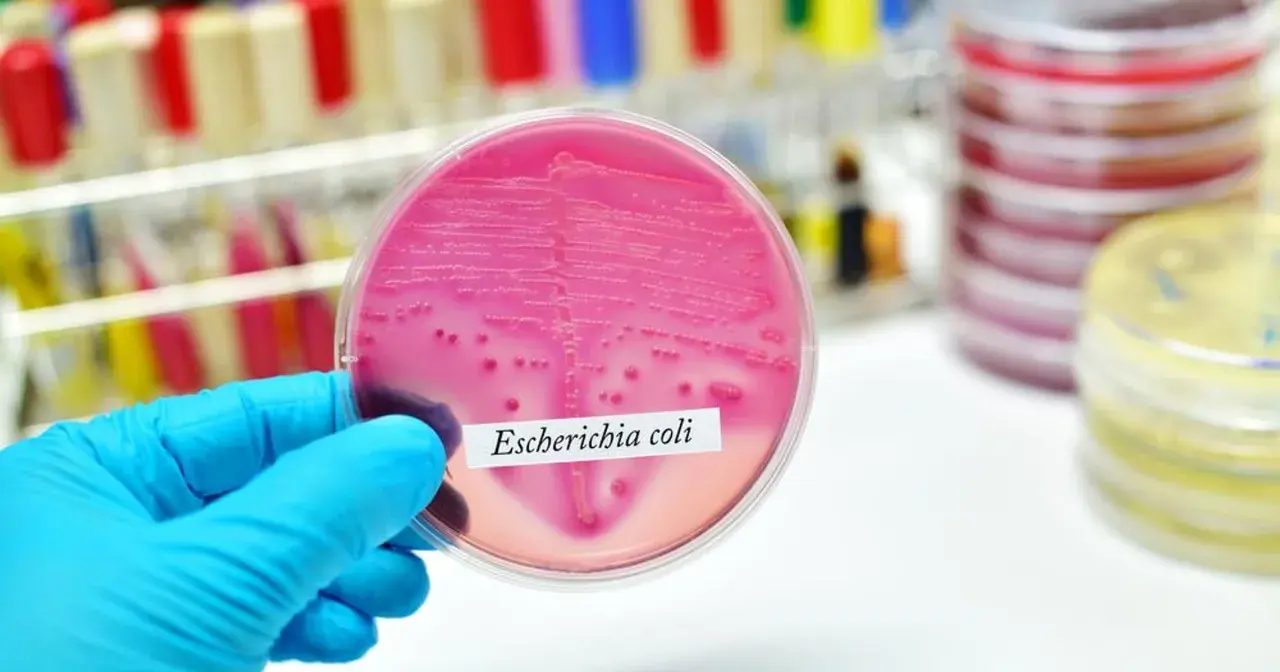 Ręka w niebieskiej rękawiczce trzyma szalkę Petriego z różowym podłożem, na którym widoczne są kolonie bakterii Escherichia coli.